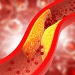 perlu-tahu-ini-faktor-yang-tingkatkan-kadar-trigliserida-dalam-tubuh-halodoc